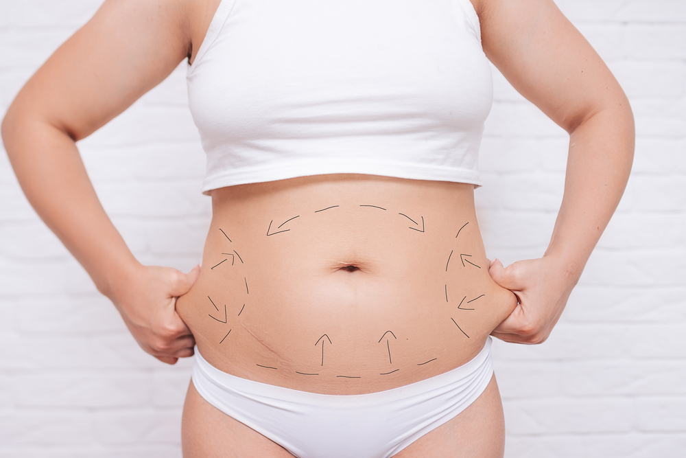 The Types of Body Contouring Offered at Mariposa Aesthetics & Laser Center | Mariposa Aesthetics and Laser Center